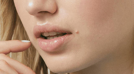 mannelijk heb vertrouwen constante Branderige, pijnlijke & gevoelige lippen | Labello