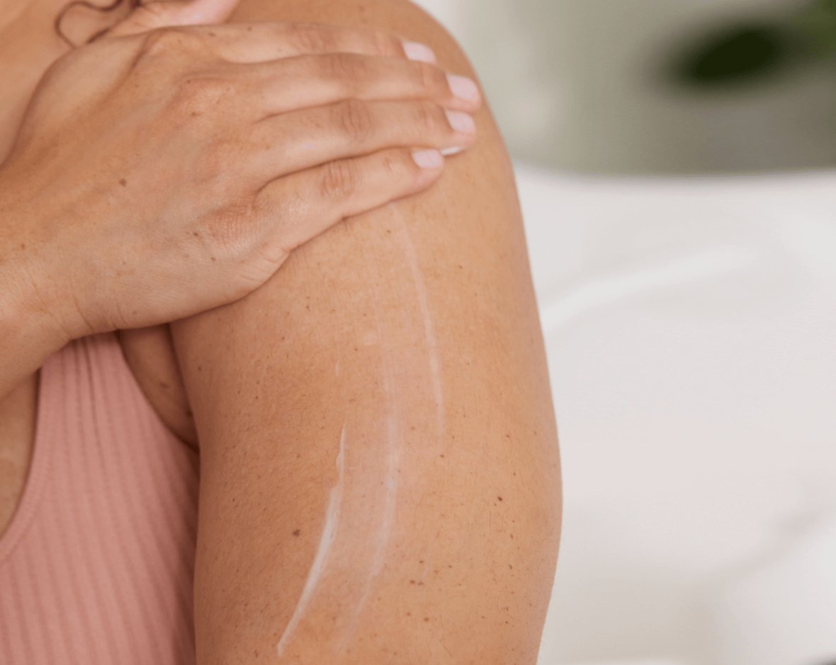 Brazo con crema para el cuidado de la piel