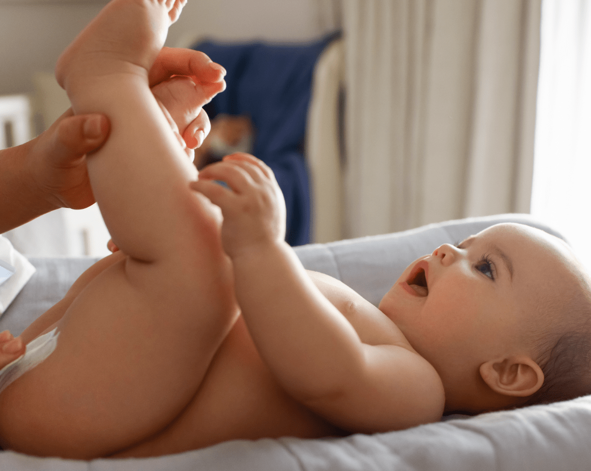 Dermatitis provocada por pañal, en la entrepierna de un bebe