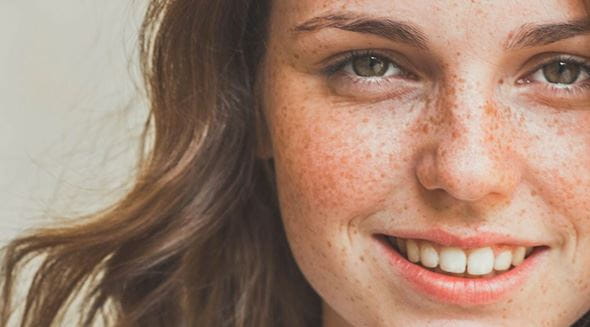 Freckles & Pigmentation