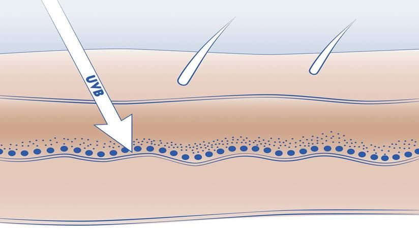 Diagram of epidermis and UVB penetration