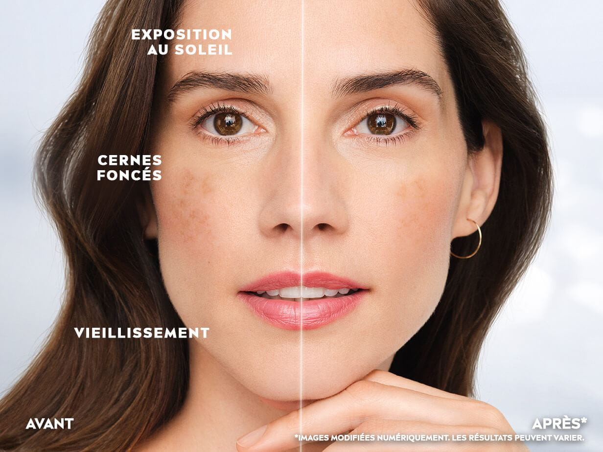 Une comparaison côte à côte du teint et de la texture de la peau d'une personne montrant les résultats avant et après.