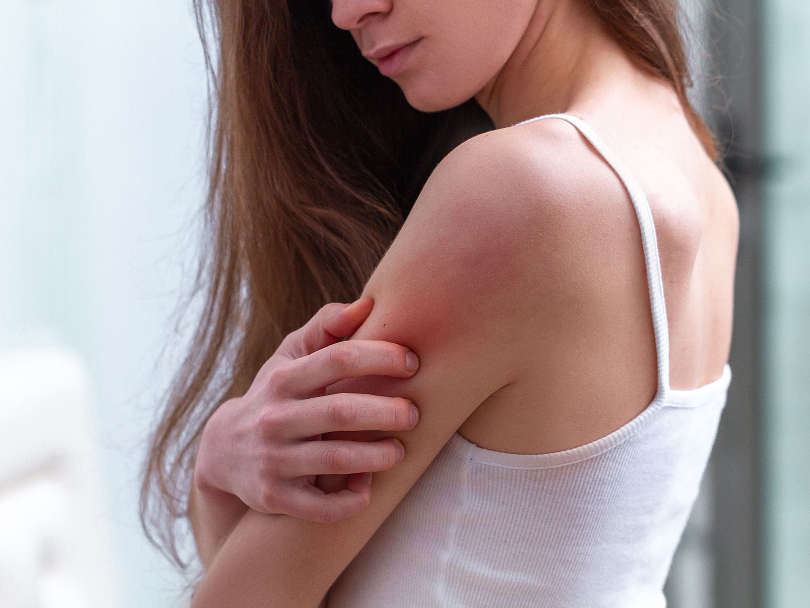 Alergie na kosmetiku: Co nás nejčastěji trápí?