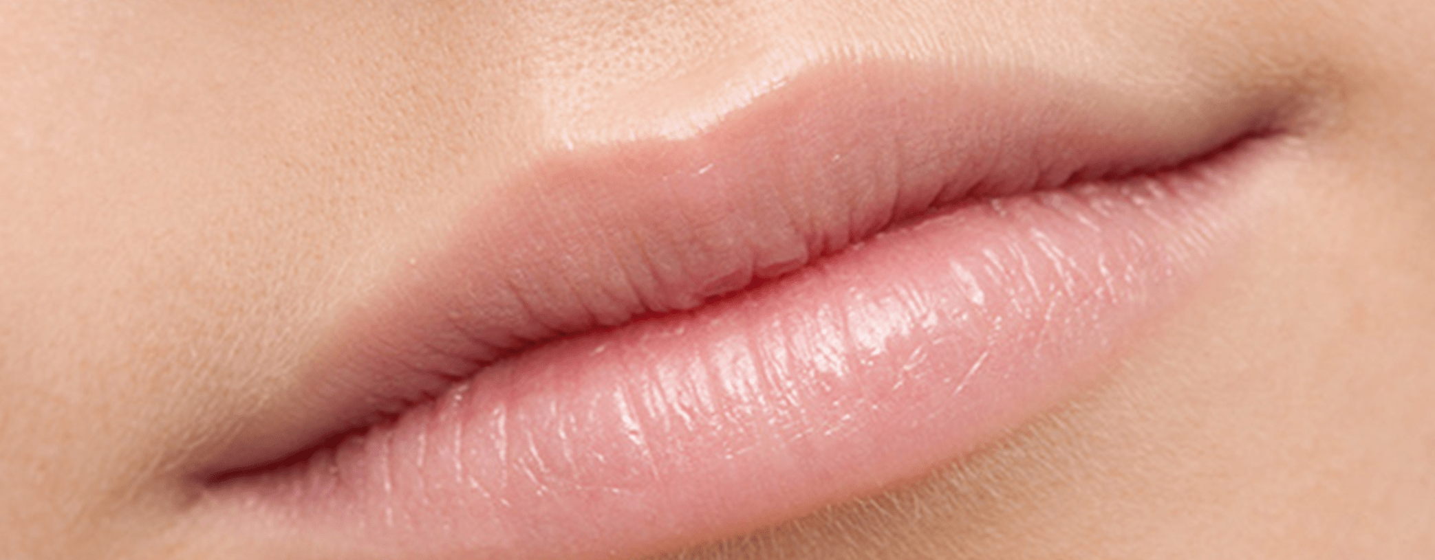 10 Penyebab Bibir Kering yang Bisa Dihindari dengan Mudah