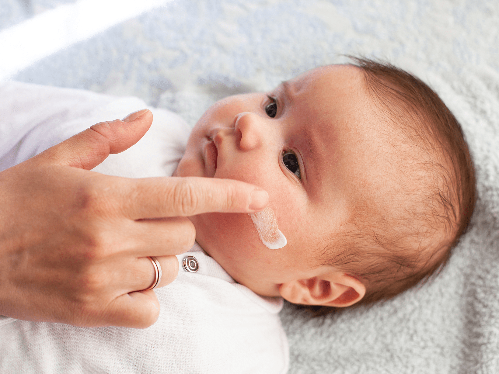 puntini rossi sulla pelle dei neonati