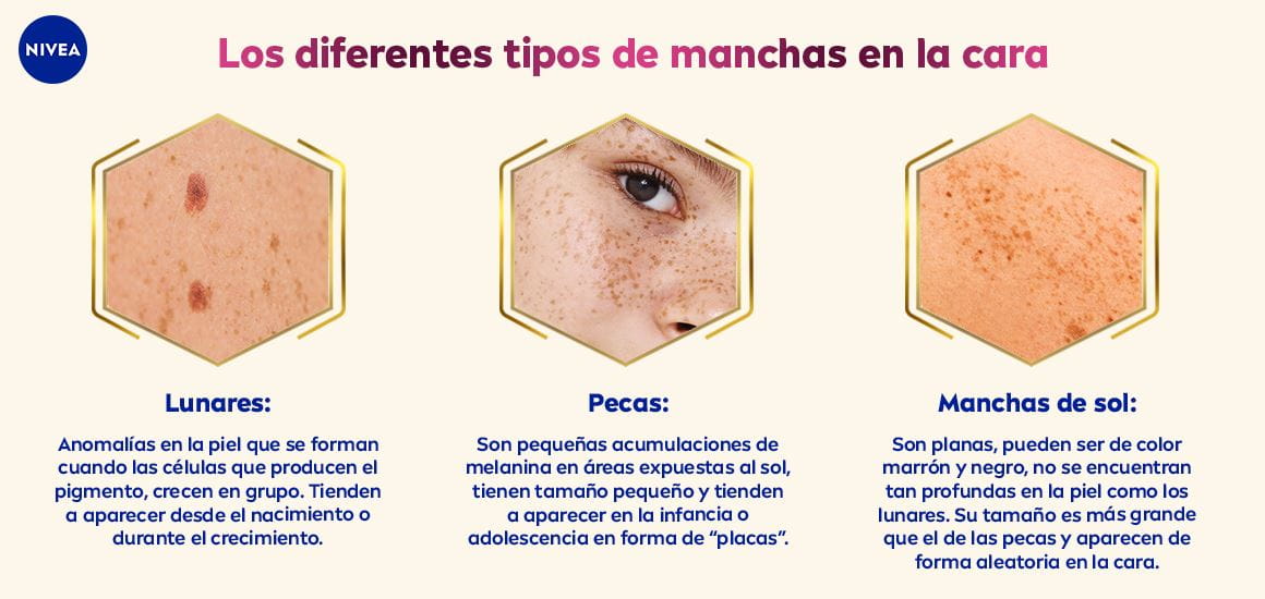 Los diferentes tipos de manchas en la cara