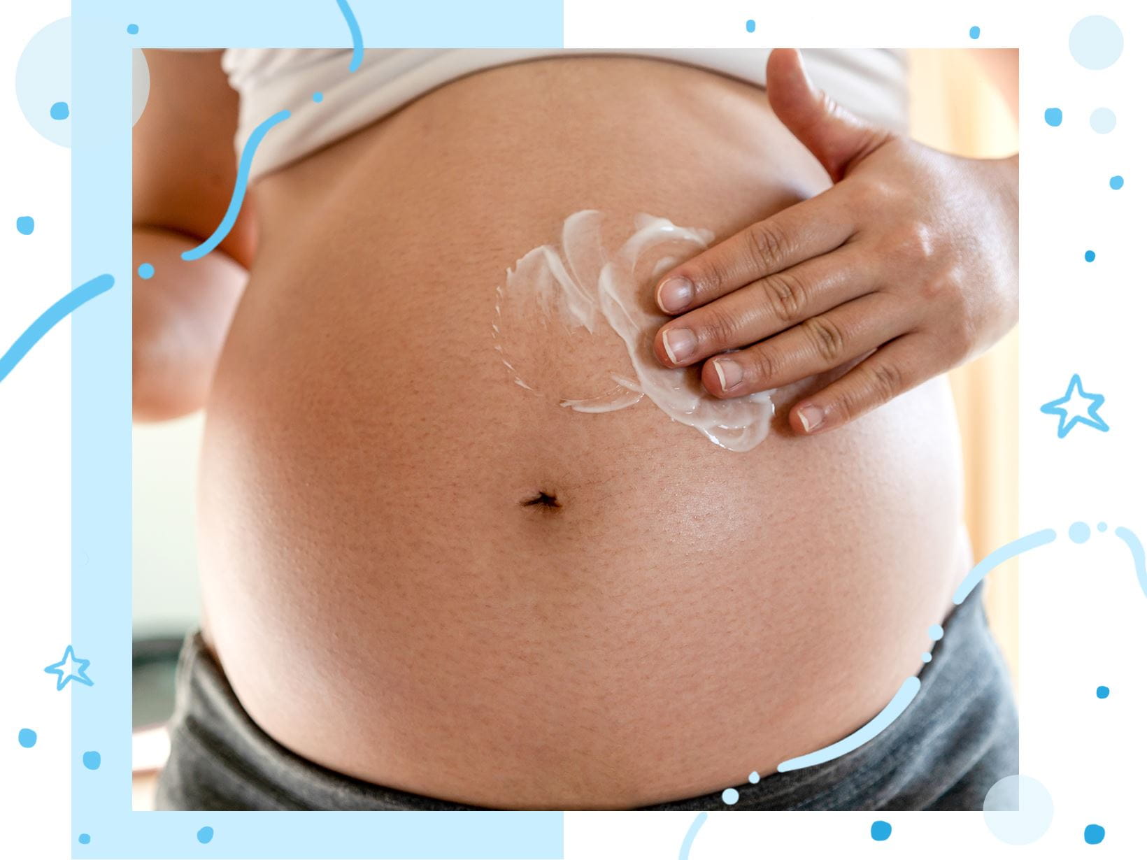 Rozstępy w ciąży – jak zapobiegać?