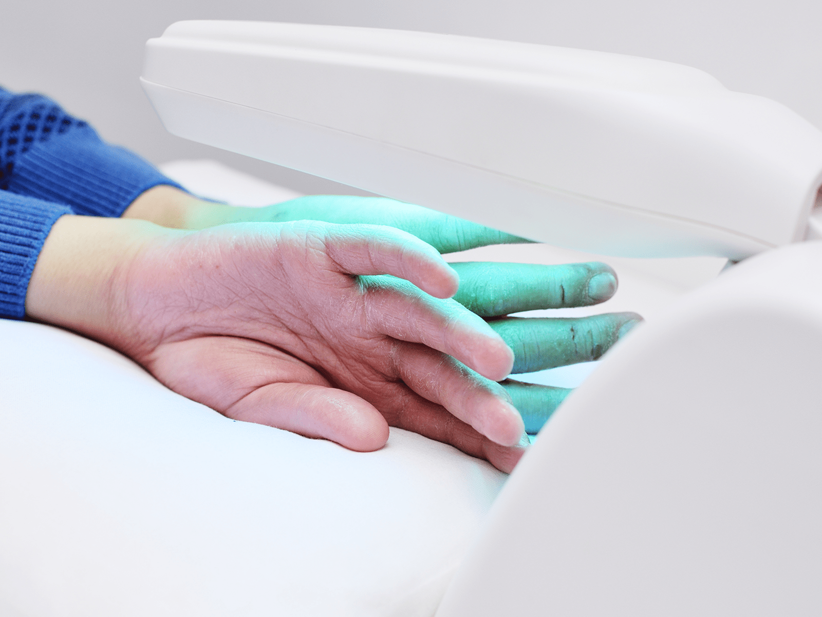 Mãos em tratamento UV